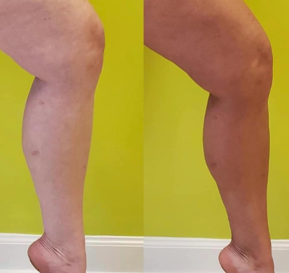 Beettan Self Tanning Mousse (Medium-Dark)